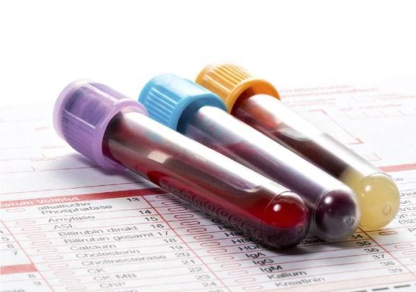 مهمترین آزمایشات خون جهت ارزیابی سلامت